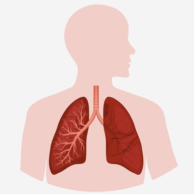 Mecanismele îmbolnăvirii aparatului respirator Fumatul, Alergia, Tulburările de circulație, Inflamația