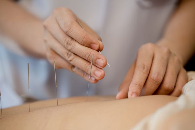 Principii fundamentale în acupunctură